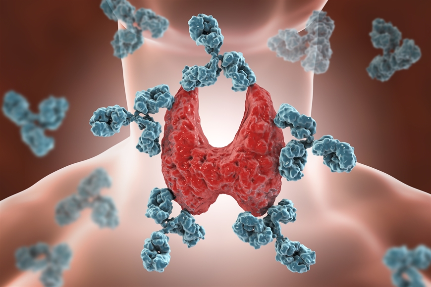 AUTOIMMUNOLOGICZNE CHOROBY TARCZYCY