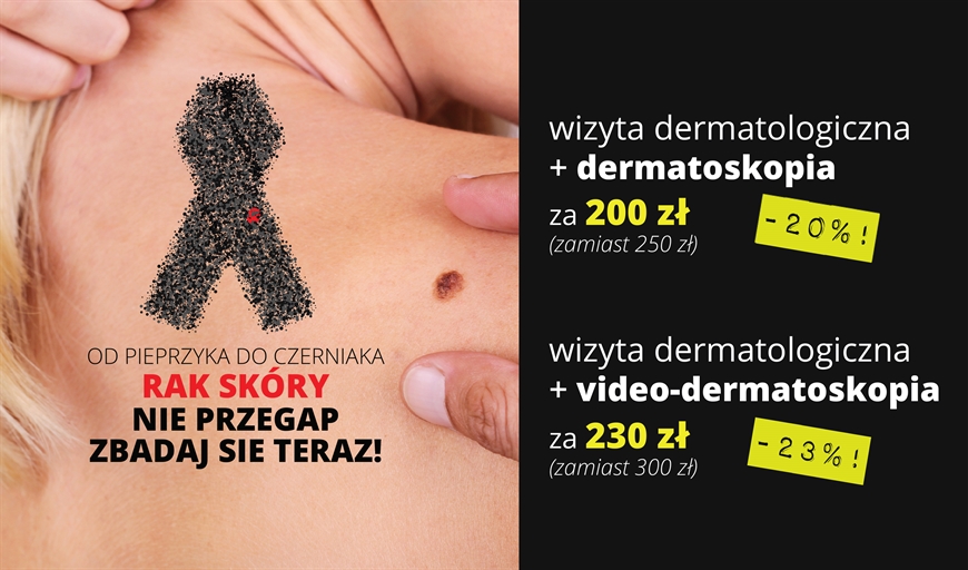 NIE PRZEGAP RAKA SKÓRY = ZRÓB DERMATOSKOPIĘ