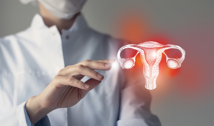 Endometrioza 