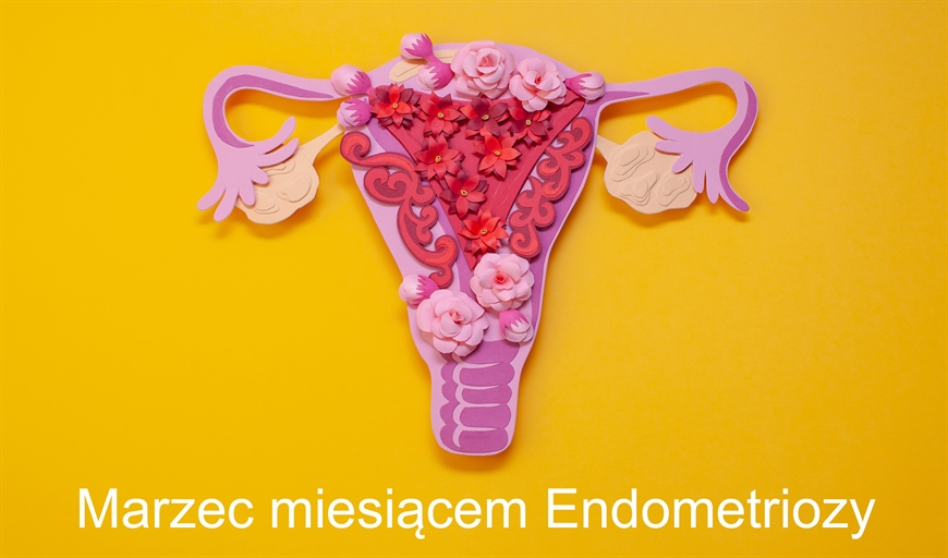 💛 Marzec miesiącem świadomości ENDOMETRIOZY